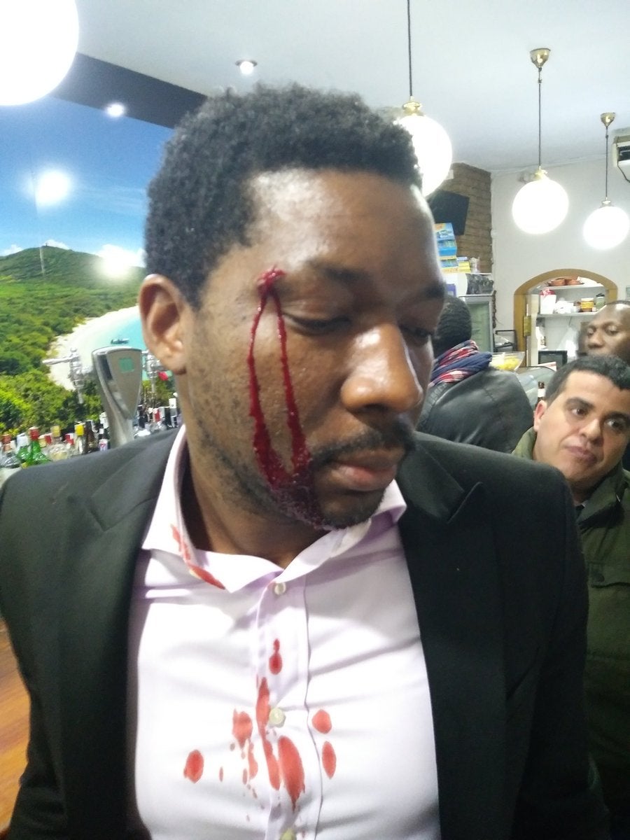 Detienen a una mujer por la agresión racista al actor Marius Makon en Madrid: "Puedo matarlo y no me pasaría nada porque soy blanca" Detienen a una mujer por la agresión racista al actor Marius Makon en Madrid: "Puedo matarlo y no me pasaría nada porque soy blanca"