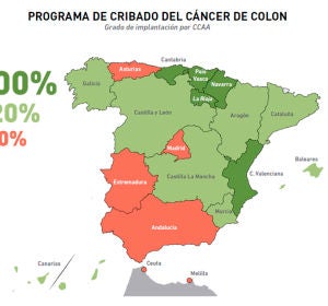 Los puntos negros del programa de cribado de cáncer de colon Los puntos negros del programa de cribado de cáncer de colon