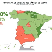 Los puntos negros del programa de cribado de cáncer de colon Los puntos negros del programa de cribado de cáncer de colon