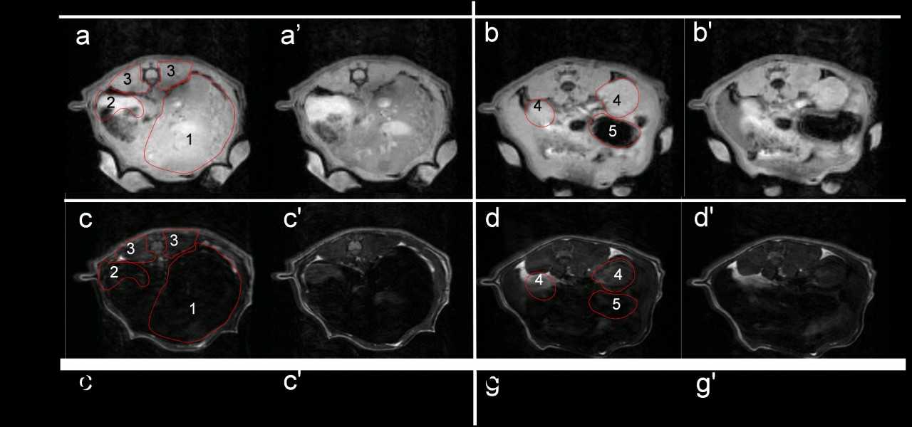 Investigadores de la UMH de Elche desarrollan nanopartículas capaces de mejorar el contraste en imágenes de resonancia magnética Investigadores de la UMH de Elche desarrollan nanopartículas capaces de mejorar el contraste en imágenes de resonancia magnética