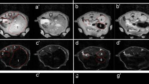 Diferencia entre las resonancias magn&eacute;ticas realizadas con y sin la nanopart&iacute;culas desarrolladas por investigadores de la UMH