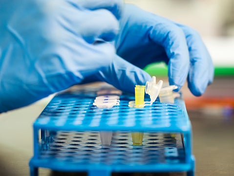 Investigadores españoles desarrollan el primer fármaco con potencial para curar la diabetes tipo 1 Investigadores españoles desarrollan el primer fármaco con potencial para curar la diabetes tipo 1