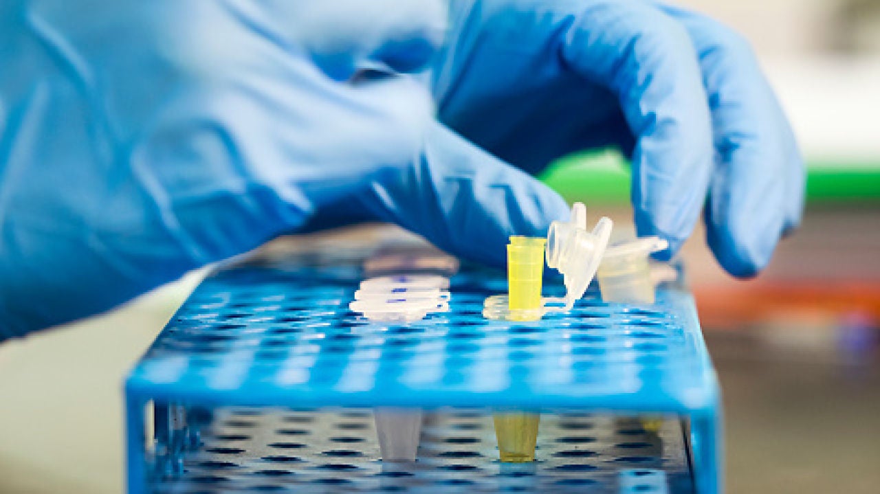 cura de la diabetes de las células alfa pancreáticas