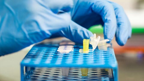 Un investigador en un laboratorio