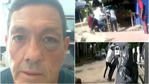 Así quedó el ojo del seleccionador tras la pelea callejera Así quedó el ojo del seleccionador tras la pelea callejera