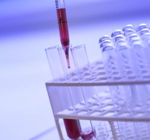 Análisis de sangre Análisis de sangre
