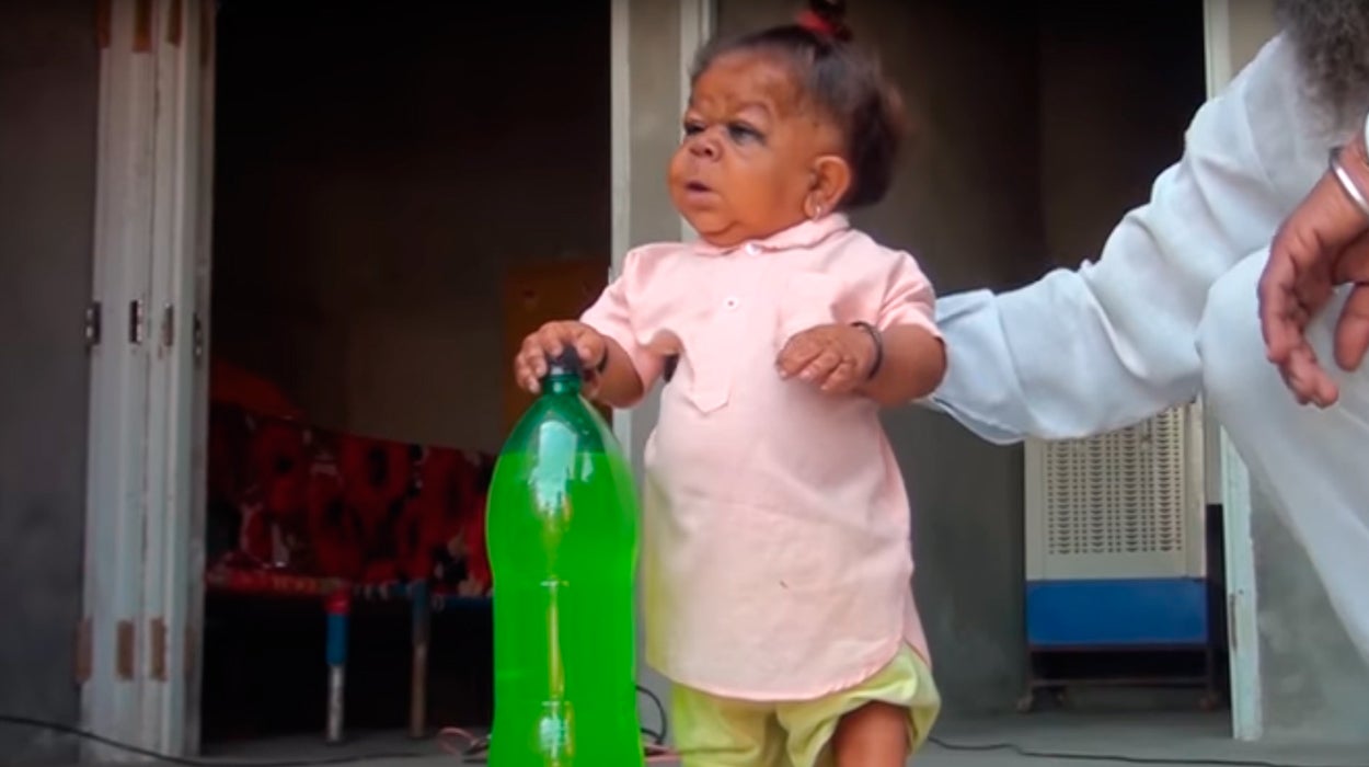 La increíble historia de un joven indio, de 23 años, que vive atrapado en el cuerpo de un niño de un año La increíble historia de un joven indio, de 23 años, que vive atrapado en el cuerpo de un niño de un año