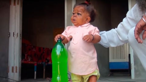 Manpreet Singh, el indio de 23 a&ntilde;os que vive atrapado en el cuerpo de un ni&ntilde;o de un a&ntilde;o