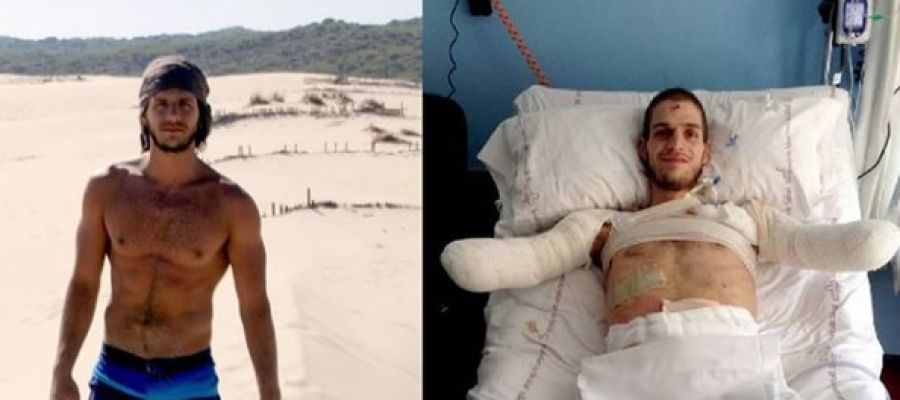 El joven Davide antes y después de ser amputado El joven Davide antes y después de ser amputado