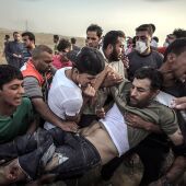 Heridos 86 palestinos en una nueva jornada de protestas en la franja de Gaza