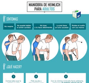 Maniobra de Heimlich en adultos Maniobra de Heimlich en adultos