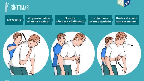 Maniobra de Heimlich en adultos