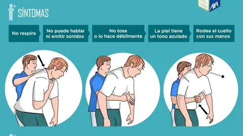 Maniobra de Heimlich en adultos Maniobra de Heimlich en adultos