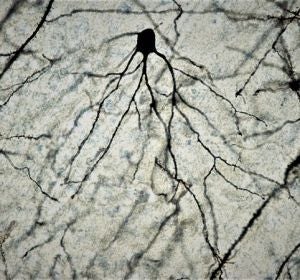 Neurona de cerebro de ratón a 100x tras tinción de Golgi-Cox. / Facultad de Medicina UCM. Neurona de cerebro de ratón a 100x tras tinción de Golgi-Cox. / Facultad de Medicina UCM.