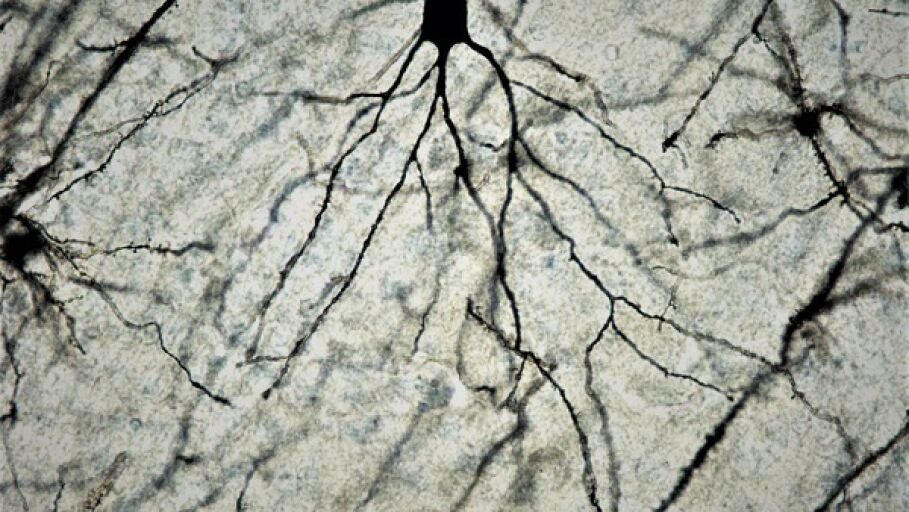 Neurona de cerebro de rat&oacute;n a 100x tras tinci&oacute;n de Golgi-Cox. / Facultad de Medicina UCM.