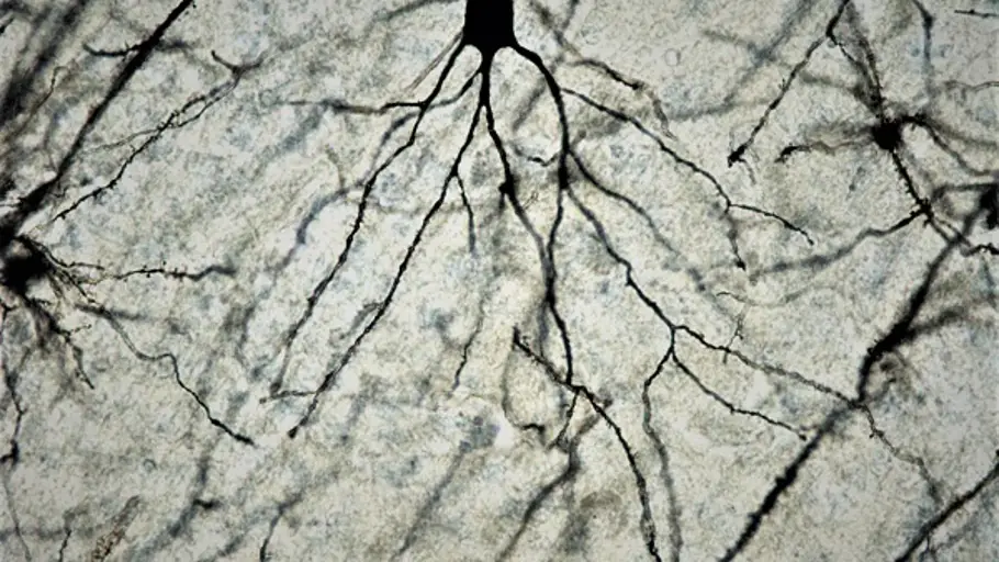 Neurona de cerebro de ratón a 100x tras tinción de Golgi-Cox. / Facultad de Medicina UCM. Neurona de cerebro de ratón a 100x tras tinción de Golgi-Cox. / Facultad de Medicina UCM.