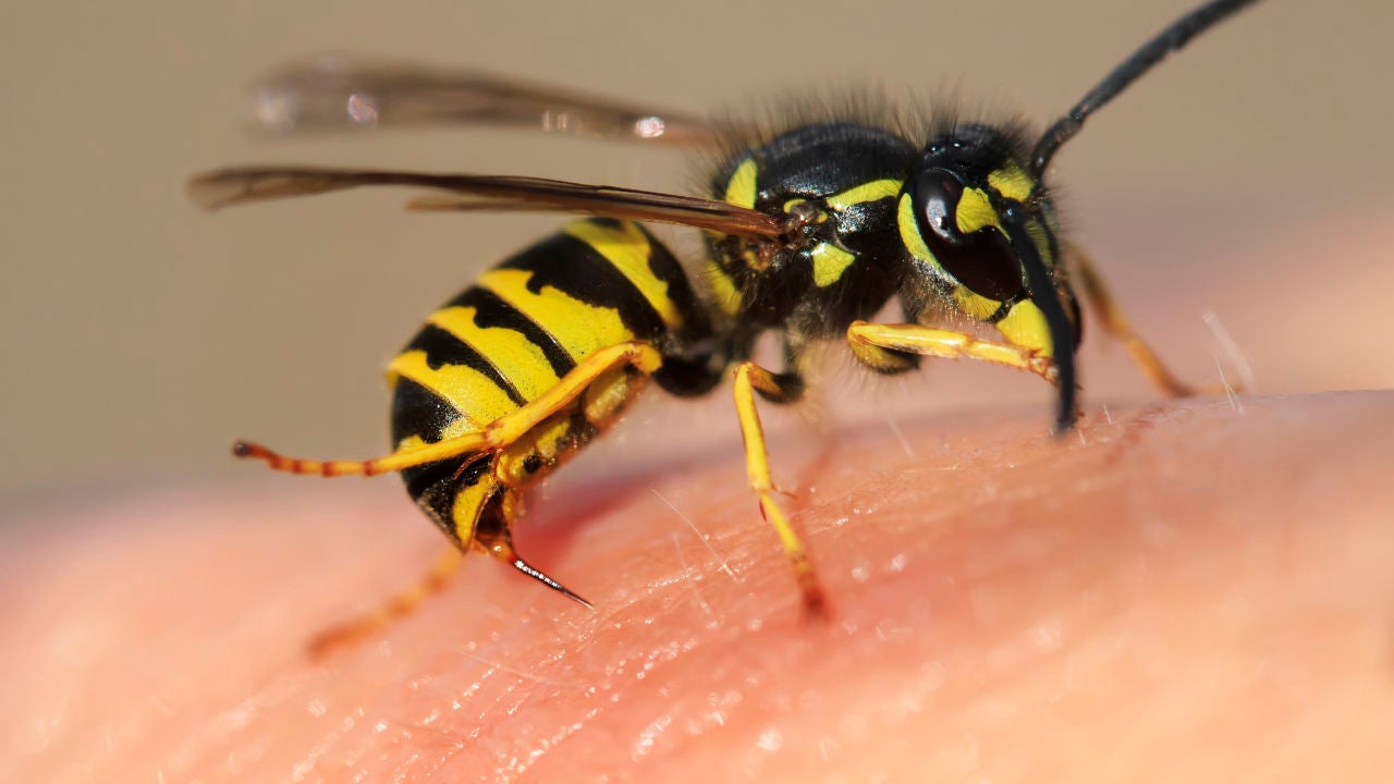 alergias a las picaduras de abejas y avispas
