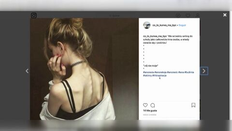 Las redes sociales hacen que aumente el n&uacute;mero de casos de anorexia
