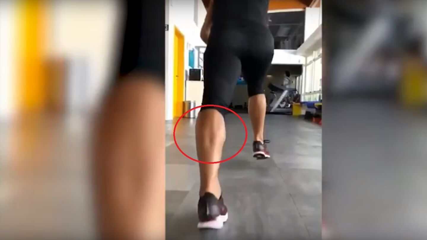 As&iacute; se rompe el tend&oacute;n de Aquiles