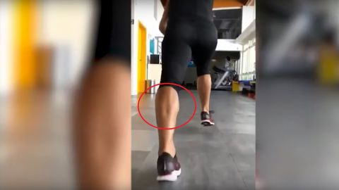 As&iacute; se rompe el tend&oacute;n de Aquiles