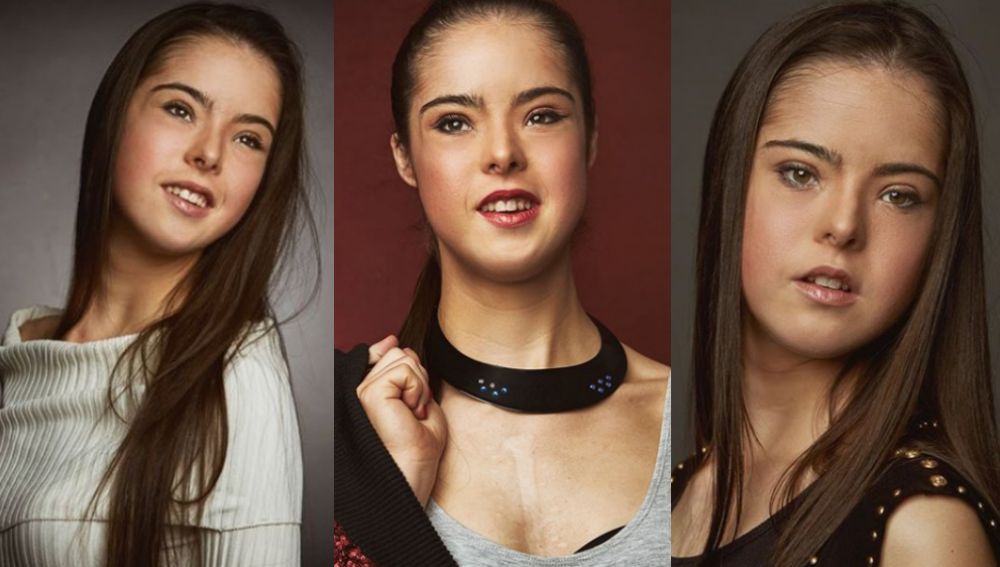 La primera modelo española con síndrome Down desfilará en Nueva York | Onda  Cero Radio