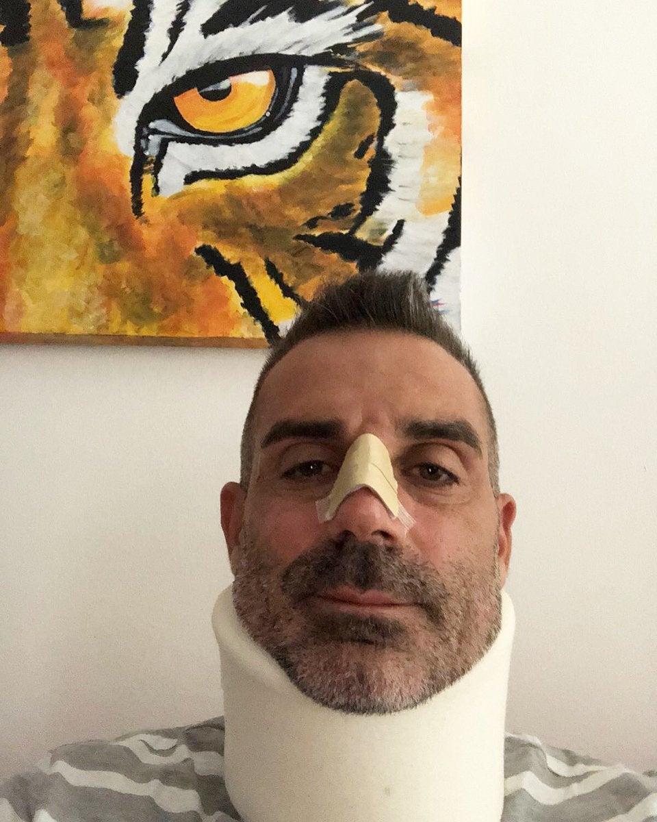 El portero del Chievo Verona sufre una fractura nasal tras su choque con Cristiano Ronaldo El portero del Chievo Verona sufre una fractura nasal tras su choque con Cristiano Ronaldo
