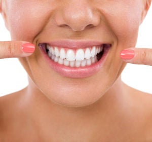 Dientes blancos Dientes blancos