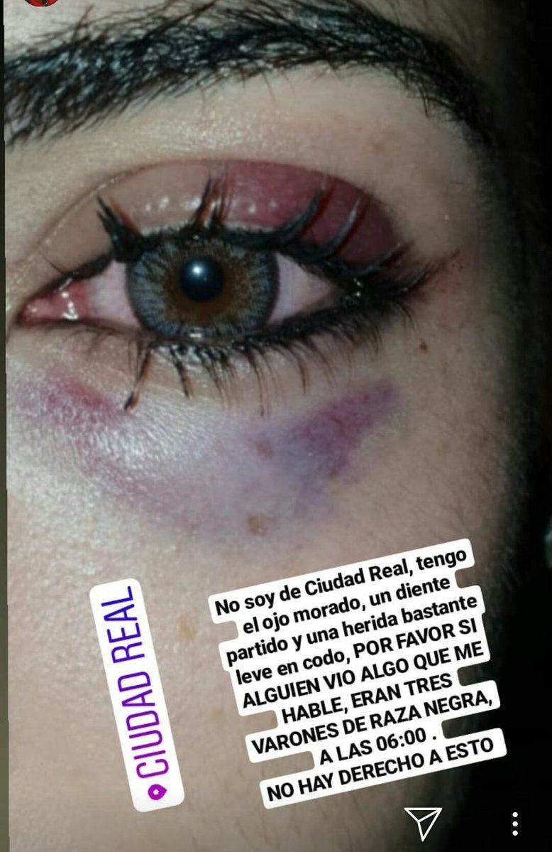 La Policía continúa buscando al presunto agresor de una joven que se negó a darle un beso La Policía continúa buscando al presunto agresor de una joven que se negó a darle un beso