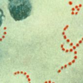 Imagen de archivo de la bacteria 'Streptococcus Pyogenes'