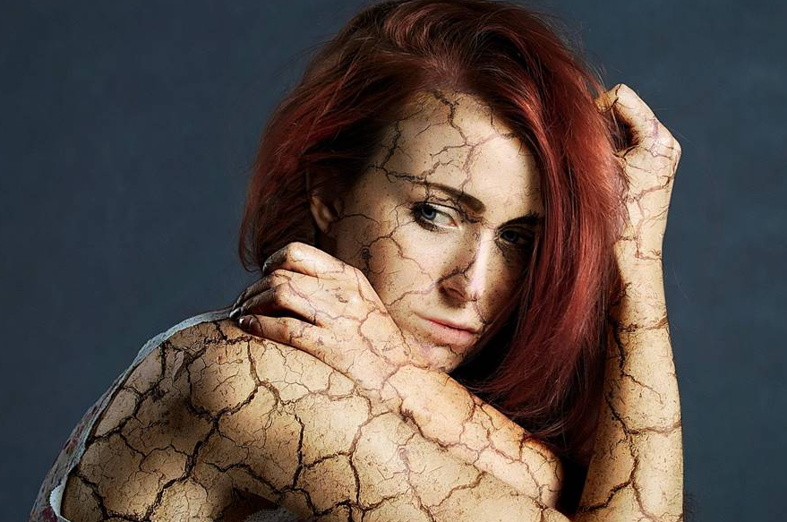 La Consulta Médica: Las hormonas de crecimiento y la fibromialgia La Consulta Médica: Las hormonas de crecimiento y la fibromialgia