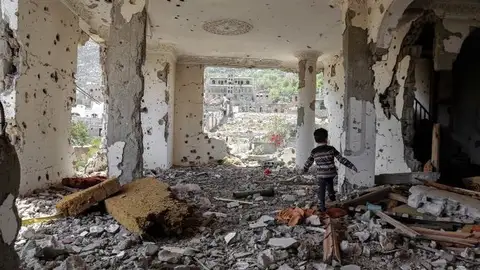 Yemen, un país en destrucción Contraparte