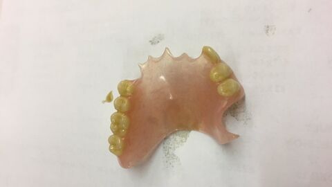 Dentadura postiza