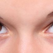 ‘Activa Tu Mirada’, campaña para prevenir y conservar la salud ocular