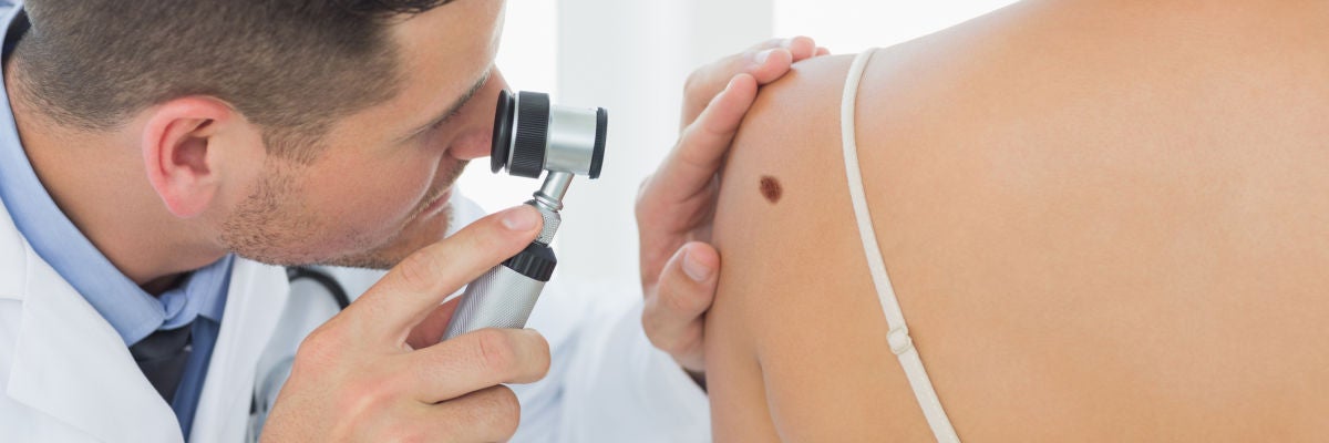 30ytantos: Cáncer de Piel 30ytantos: Cáncer de Piel