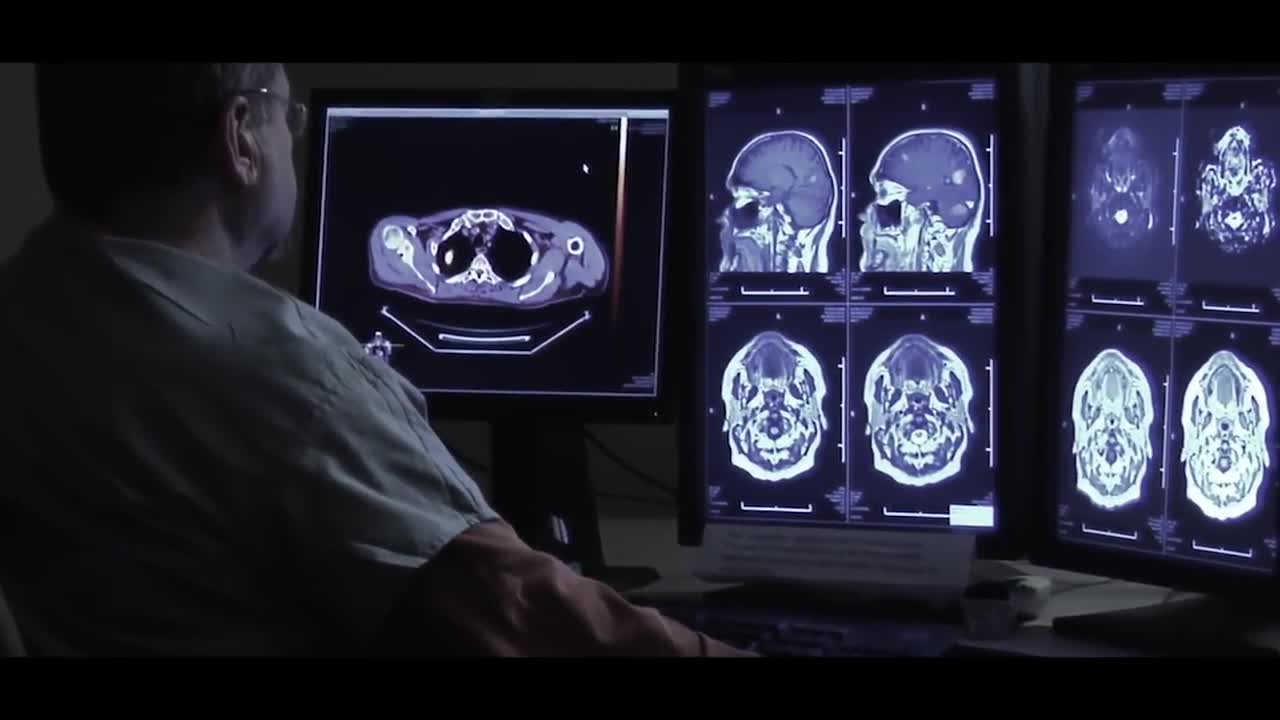 Les malalties del cervell són la major causa de discapacitat Les malalties del cervell són la major causa de discapacitat
