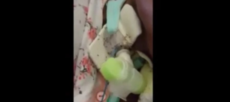 Mujer cubierta por hormigas en un hospital de Italia Mujer cubierta por hormigas en un hospital de Italia