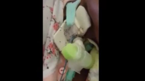 Mujer cubierta por hormigas en un hospital de Italia
