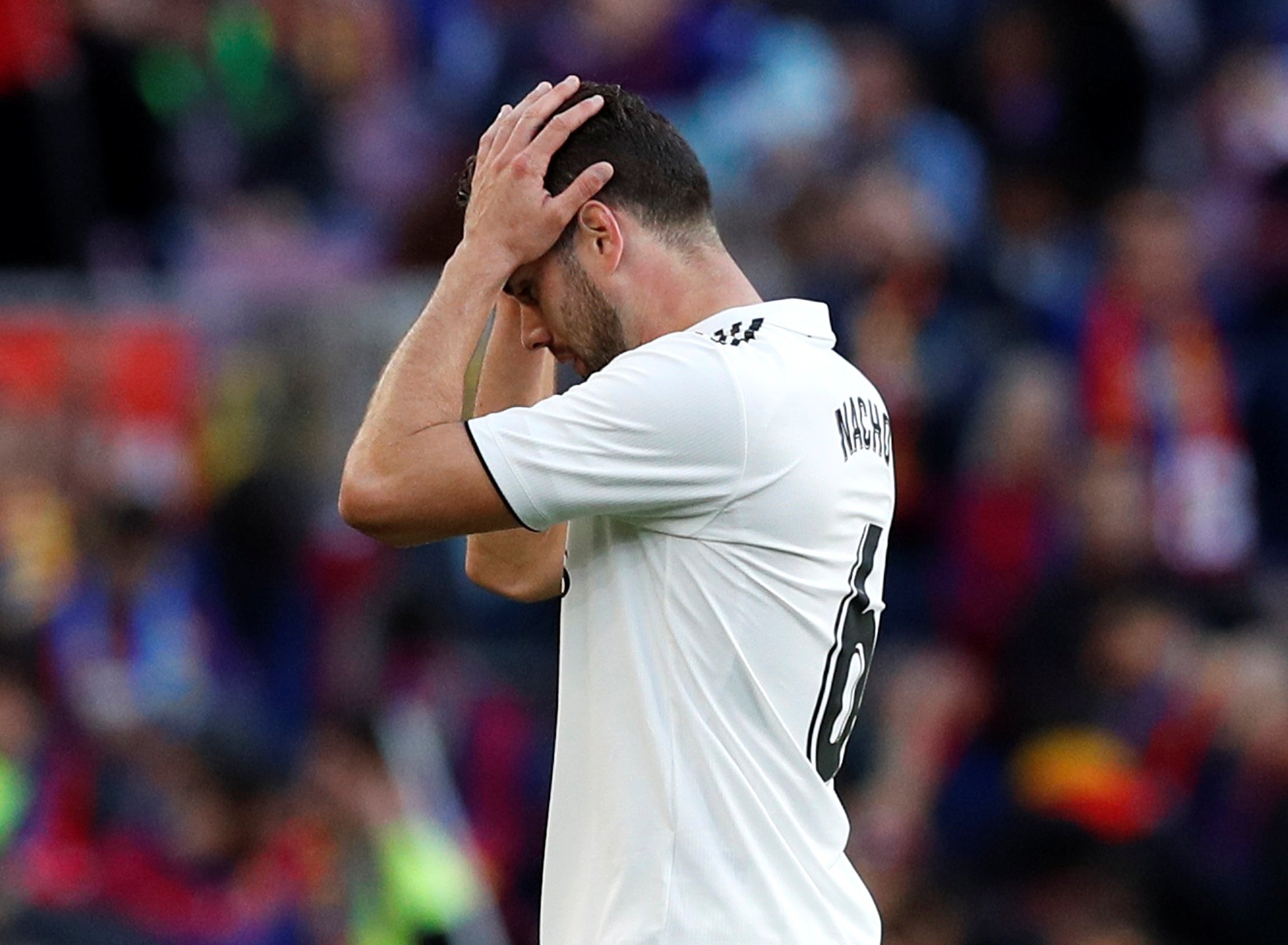 Nacho estará dos meses de baja y Casemiro unas tres semanas KO Nacho estará dos meses de baja y Casemiro unas tres semanas KO