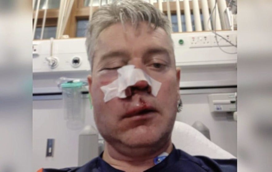 Unos jugadores parten la cara a un árbitro en el aparcamiento de un campo de fútbol Unos jugadores parten la cara a un árbitro en el aparcamiento de un campo de fútbol