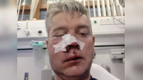 Daniel Sweeney, en el hospital tras la agresi&oacute;n