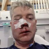 Daniel Sweeney, en el hospital tras la agresión