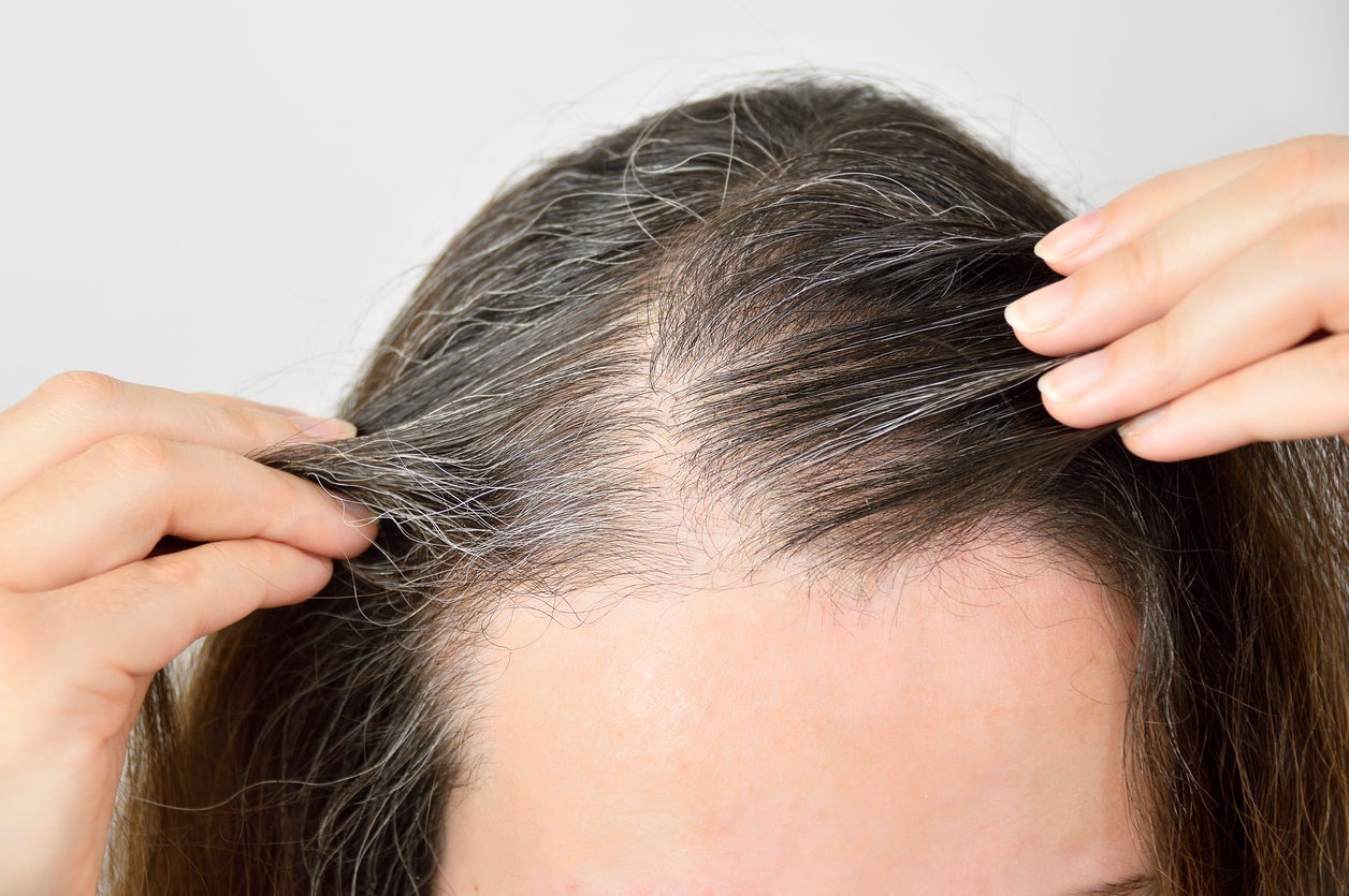 Descubren la relación directa entre el estrés y las canas Descubren la relación directa entre el estrés y las canas
