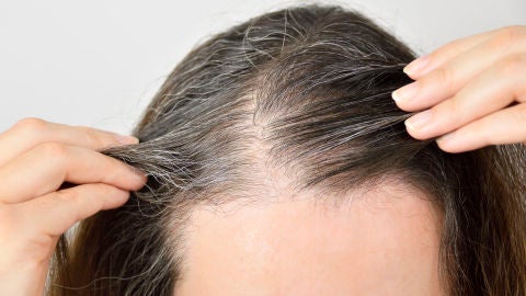Canas