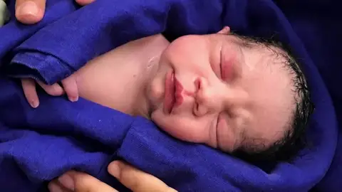 Nace en Brasil la primera bebé del mundo a través de un trasplante de útero de una donante muerta Nace en Brasil la primera bebé del mundo a través de un trasplante de útero de una donante muerta
