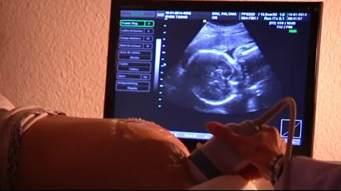 Muere un beb&eacute; en Vigo en un parto en casa sin asistencia m&eacute;dica