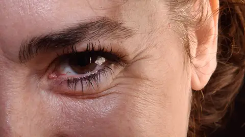 Patas de gallo Patas de gallo