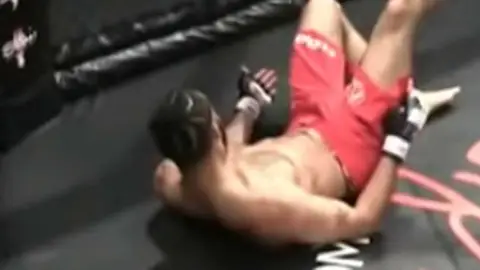 Terrible lesión en el MMA Terrible lesión en el MMA