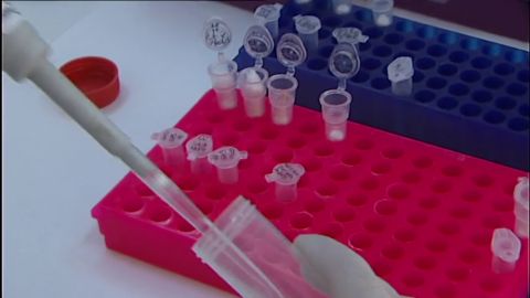 Un estudio alerta del aumento de los casos de contagio del subtipo B del VIH