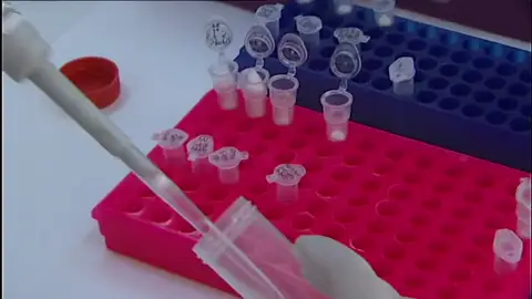 Un estudio alerta del aumento de los casos de contagio del subtipo B del VIH Un estudio alerta del aumento de los casos de contagio del subtipo B del VIH