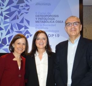 Osteoporosis: El ejercicio físico y mantener una ingesta de calcio y vitamina D ayudan a prevenirla Osteoporosis: El ejercicio físico y mantener una ingesta de calcio y vitamina D ayudan a prevenirla